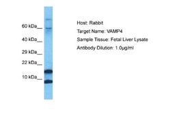 VAMP4 Rabbit anti-Human, Polyclonal, Novus Biologicals 0.1ml; Unconjugated:Antibodies,